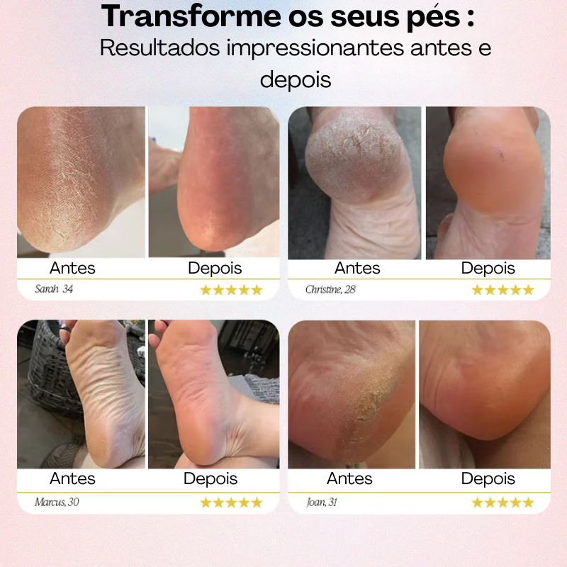 RemoBelleza™