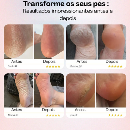 RemoBelleza™